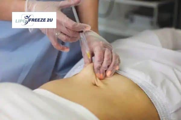 Fat Dissolving Injections Widnes & Weight loss medication