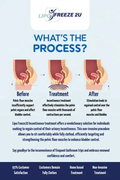 Diagram of how incontinence treatment Widnes works.