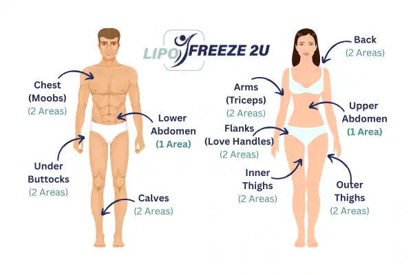 Areas you can have fat freezing treatment Widnes