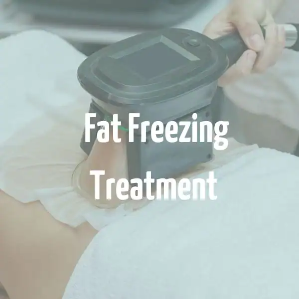 fat freezing treatment Widnes