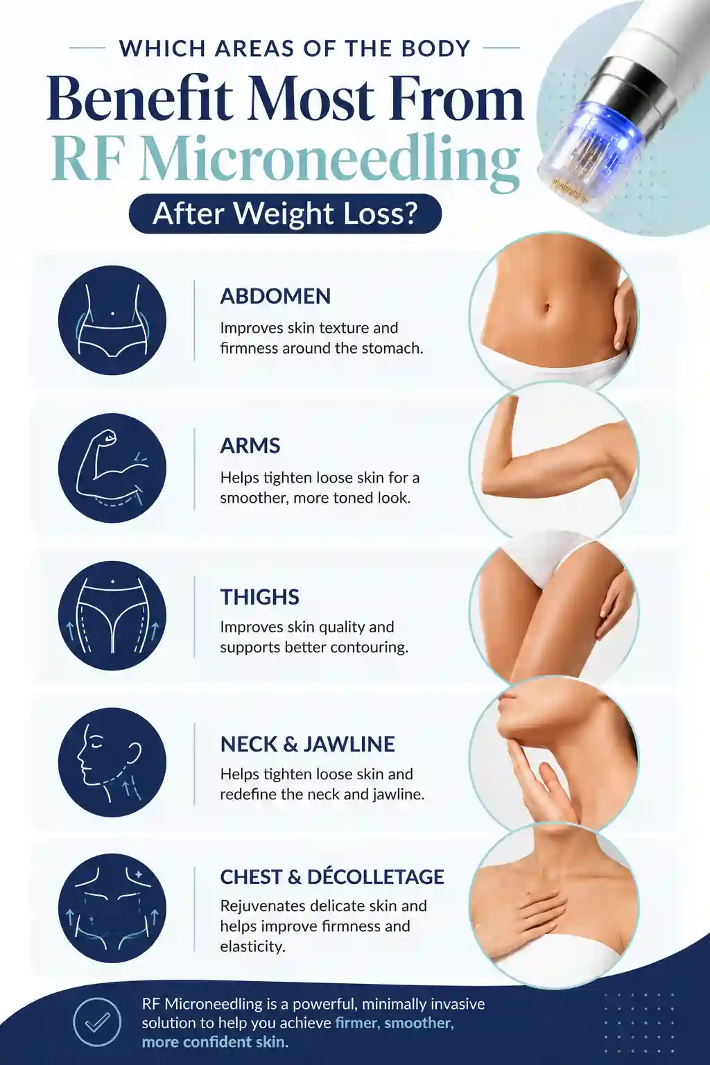 Which Areas of the Body Benefit Most From RF Microneedling After Weight Loss Widnes